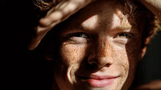 En närbild av en person med fräknar i ansiktet.