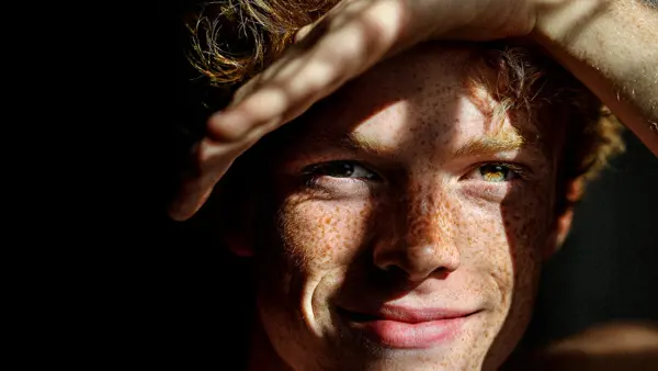 En ung man med fräknar håller handen över huvudet.