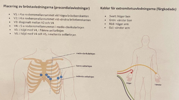Instruktion som ett stöd när man ska ta ett EKG