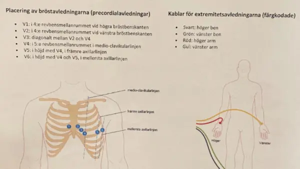 Instruktion som ett st&ouml;d n&auml;r man ska ta ett EKG